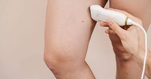 maintaining vein health